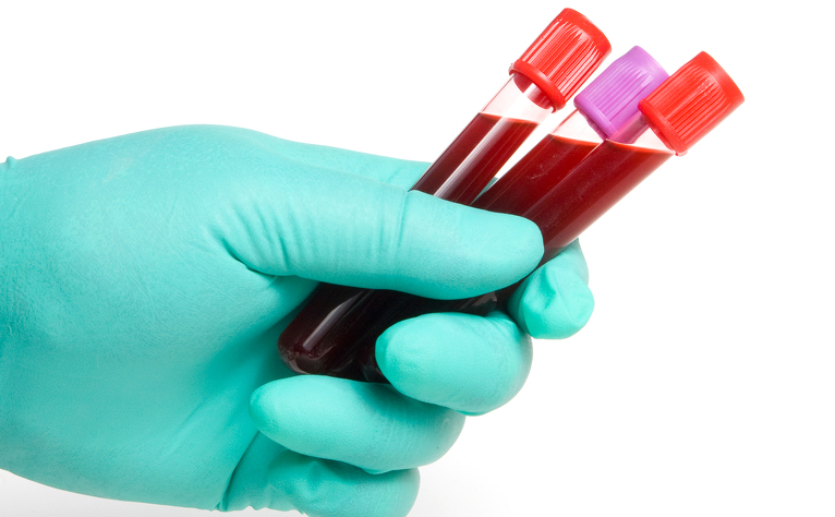 What do ferritin levels in a blood test measure?