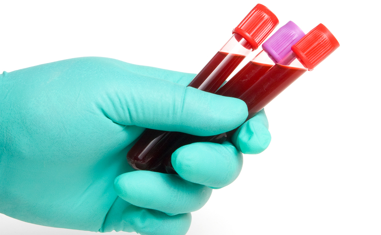 essays on phlebotomy essays on phlebotomy